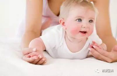 婴儿面部湿疹怎么护理效果最好,湿疹的护理方法与注意事项