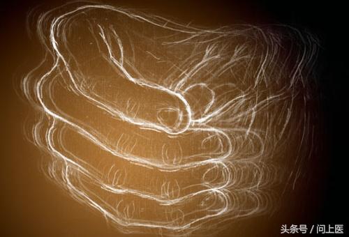 全方面了解帕金森疾病,从小帕金森怎样锻炼