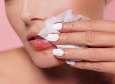 怎样淡化唇纹效果最好的方法,减少唇纹的有效方法