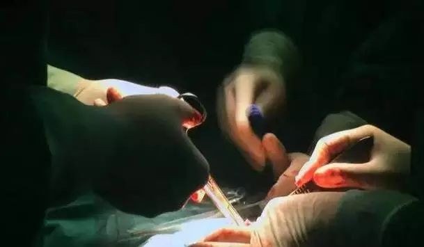 孩子生出来脐带一直不剪会窒息,孩子出生胎盘出来前剪脐带吗