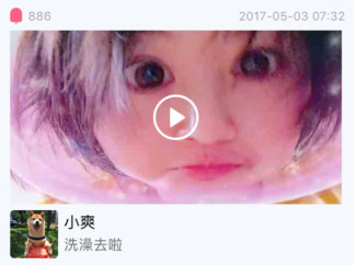 郑爽压力大深夜失眠嘴角上火，头发凌乱还不忘卖萌放飞自我！