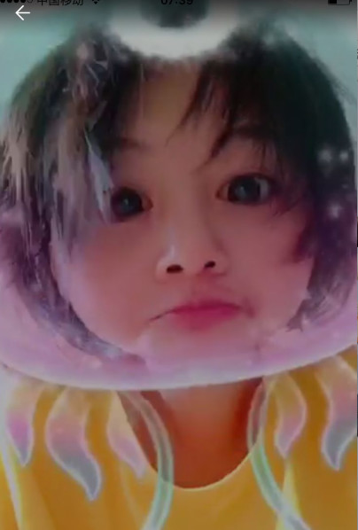 郑爽压力大深夜失眠嘴角上火，早晨起床头发凌乱不忘卖萌放飞自我