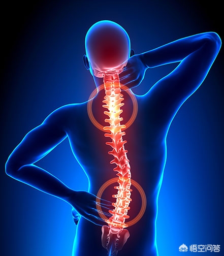 腰椎间盘突出能转呼啦圈健身吗,腰椎间盘突出微创手术后还能健身