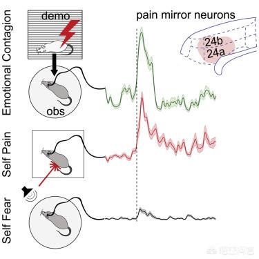 看到别人伤口疼自己也会感觉痛,看见别人疼自己也会疼是怎么回事