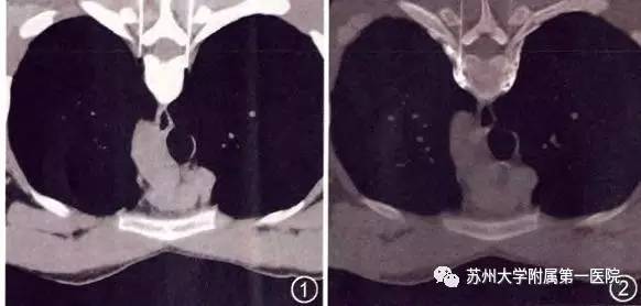 每天汗如雨下好不好,每天都汗如雨下