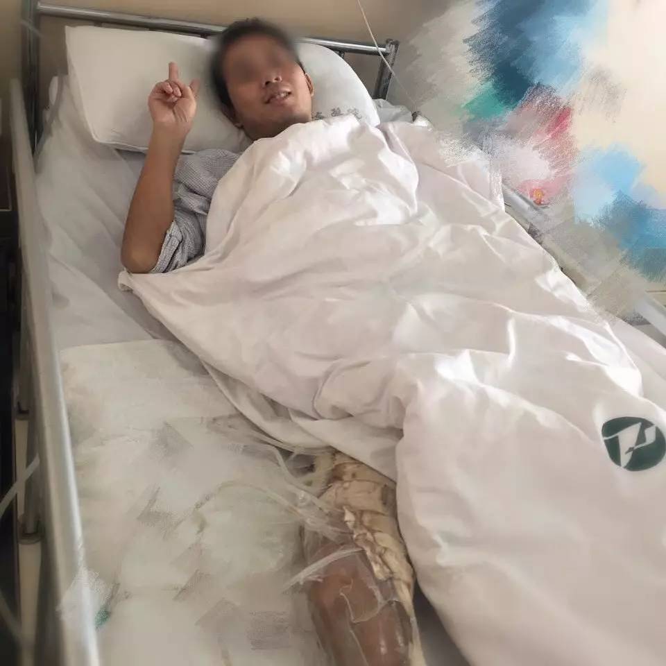 感冒脓毒血症,小孩感冒引起的脓毒血症