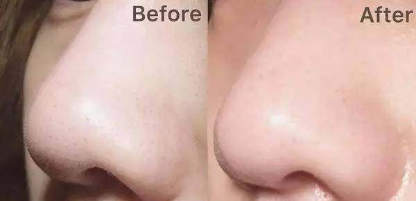 强烈推荐一款清洁面膜超好用,推荐几款便宜又好用的清洁面膜