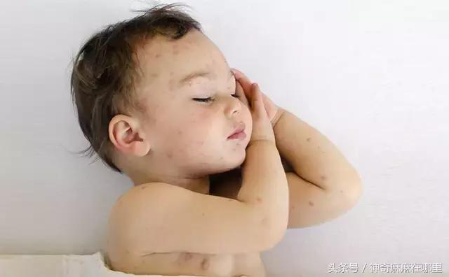 让蚊子叮用什么药,夏天蚊子多儿童驱蚊产品哪种好