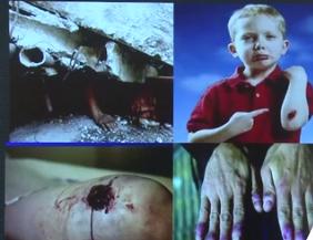 创伤急救原则是什么,头部创伤人员哪些急救措施不正确