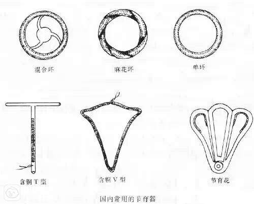 英国一宝宝握着避孕环诞生,霸气侧漏!