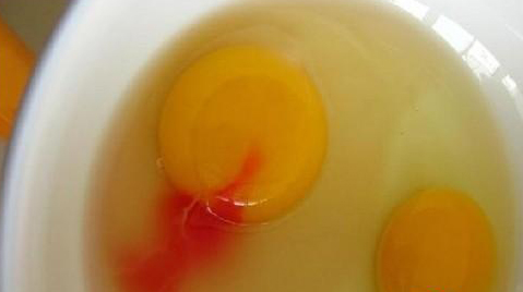 最新梅方受伤视频,梅方足球最新消息