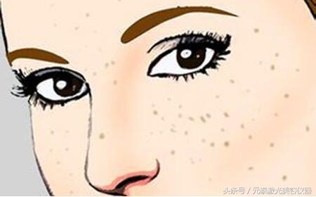 中医脸上有雀斑怎么最快祛除,如何从内到外调理雀斑