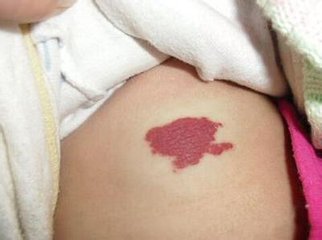 宝宝被年轻妈妈吻后中风丧命,“种草莓”游戏不能乱玩