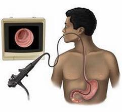 做胃镜很痛苦，有什么办法可以让做胃镜不再受罪？这两个办法好！