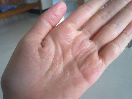 李铁红大夫专业,李铁红医生靠谱吗