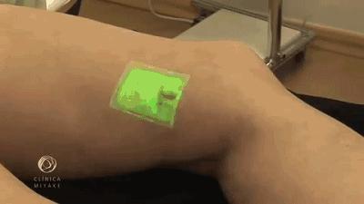 这个黑科技能照亮你的血管，让护士好好地给你扎针！