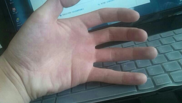 高考手心出汗怎么治,高考的时候手心出汗怎么缓解