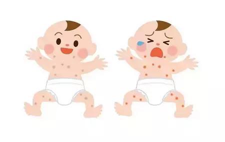 宝宝长痱子什么方法治最好,宝宝长痱子怎么治疗效果最快