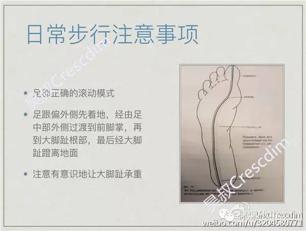 扁平足的矫正方法,2岁扁平足需要矫正么