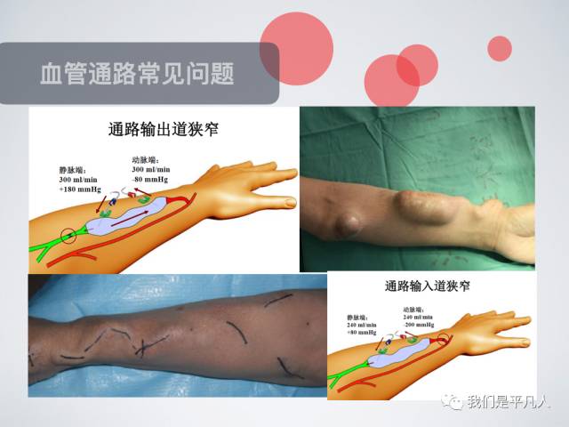 血透净化标准操作规程,血液净化基本操作技术