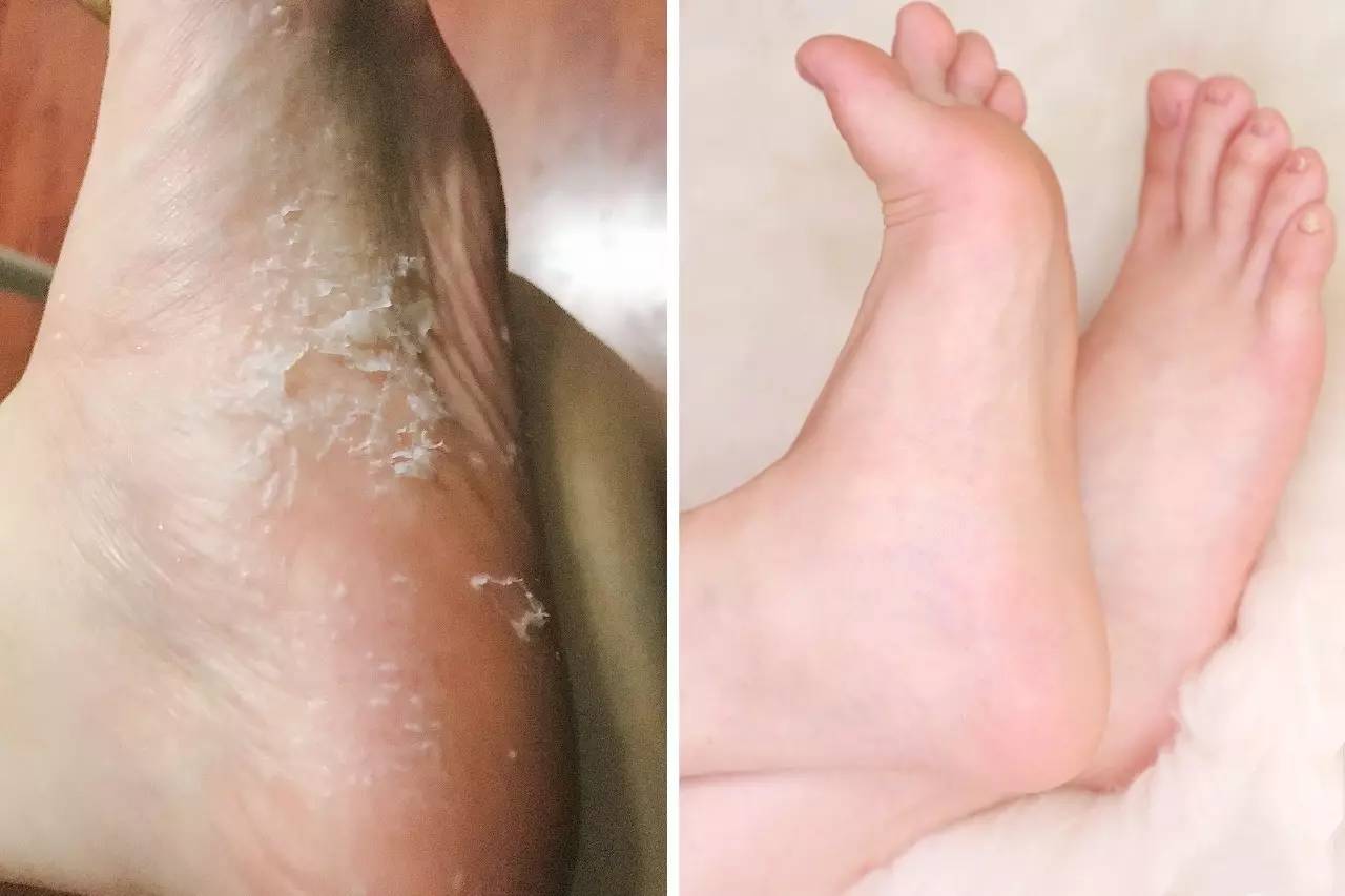 为什么总觉得自己不适合穿高跟鞋,为啥穿高跟鞋不好看