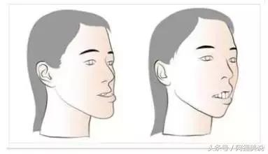 小孩子牙齿全部烂光,五岁男孩牙齿全烂了