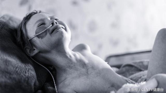 4岁小女孩患癌,4岁小女孩得癌症