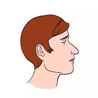 长痘痘的原因你知道有多少,长痘痘的原因你了解多少