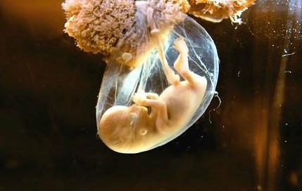 羊水破了是什么感觉如出现这情况就赶紧去医院