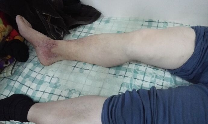 涓嬭偄闈欒剦鏇插紶濡備綍閿荤偧,涓嬭偄闈欒剦鏇插紶涓尰杈ㄨ瘉璁烘不