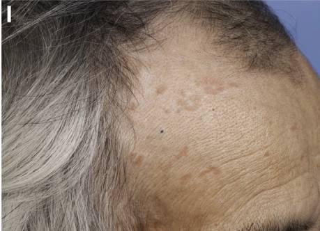 腹泻的不同类型及病例,腹泻的不同原因及现象