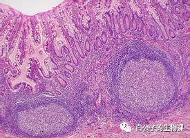 300倍显微镜能观察什么,什么东西可以通过显微镜来观察