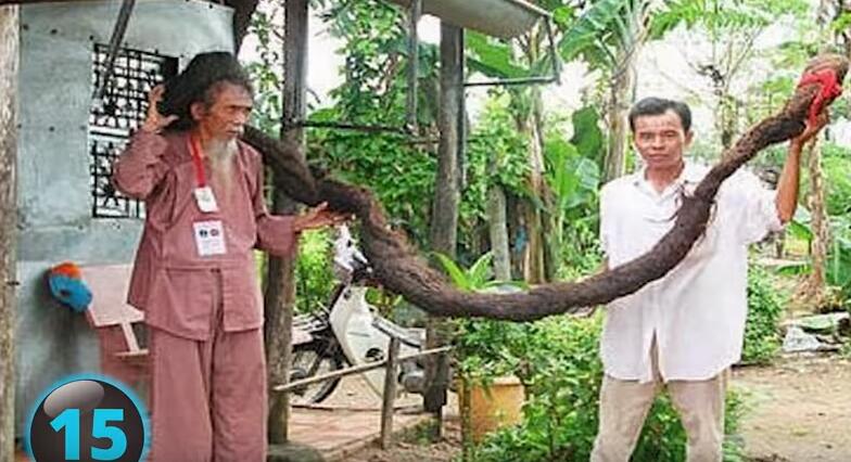 他们才是真正的超人，再大的挫折都挫不到他们，头不全又怎样