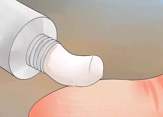 纹身过敏症状怎么处理,纹身细菌感染怎么治疗