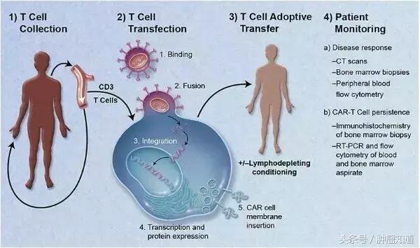 害怕乳腺癌切不净会复发?!新技术帮你杜绝复发风险!