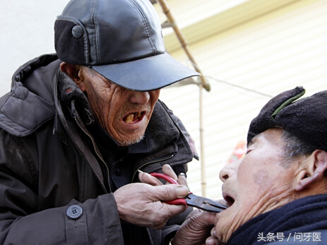 拔牙后出血不止是怎么回事,拔牙后出血不止引起死亡