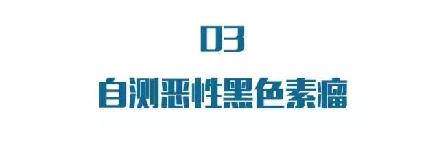 长在什么地方的痣易癌变,每一个痣都是代表疾病吗