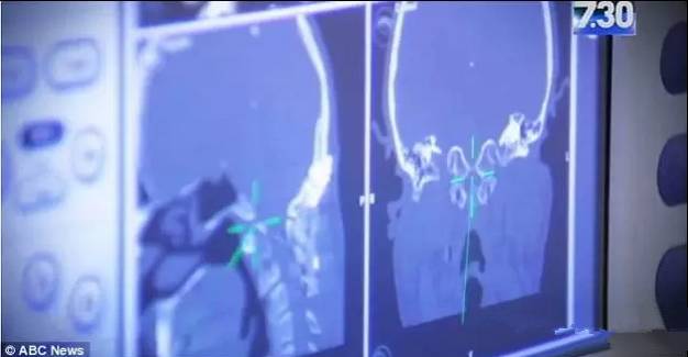 Sun资讯速递澳洲医学再次震惊全宇宙！澳洲医生完成全球首例人头分离手术！罕见癌症就这么治好了！