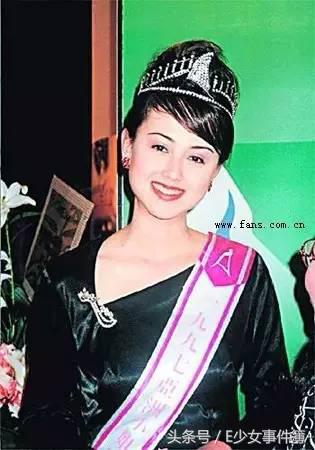 最美亚姐,韩君婷的鼻子是整容失败吗