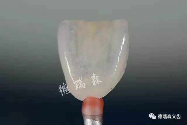 德瑞森义齿在哪,德瑞森义齿多少钱