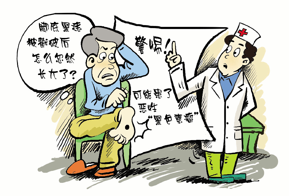 痣是怎么发展成癌症,长痣是患癌的前兆吗