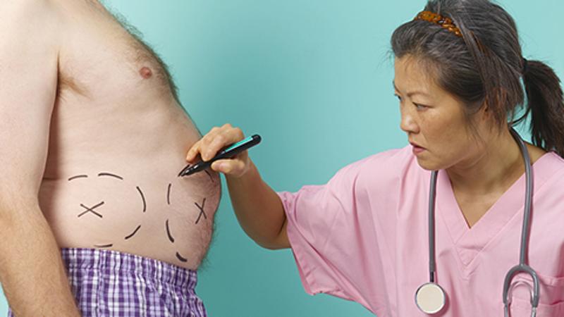 手术减肥的利弊,手术减肥副作用大吗