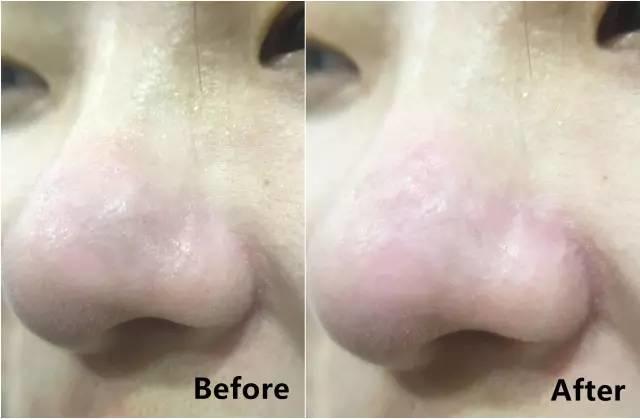 rydeen白泥清洁泥膜效果怎么样,平价好用的清洁泥膜测评