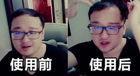 德云色笑笑近况,德云色笑笑植发后现在效果如何