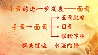 中医看手掌红判断疾病,中医怎么看手掌病