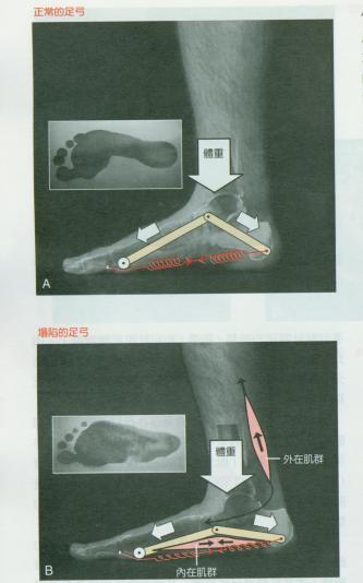 大粗腿该怎么穿,如何改善腿粗小妙招
