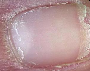 肝出问题身体有什么明显变化,6个症状说明你的肝出问题了