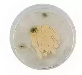 快翻翻你的包里有没有这些东西！放时间长了=毒药！