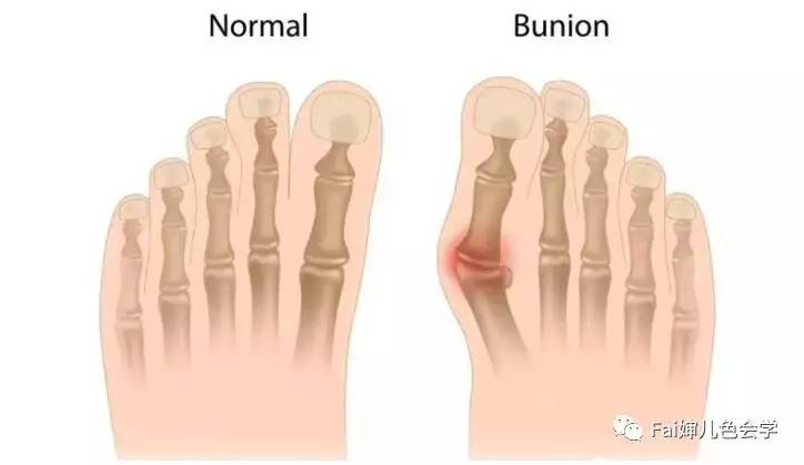 不吃藕｜恋足癖都嫌弃你的脚，你好意思吗~