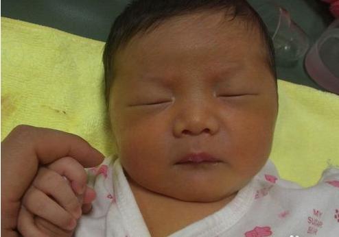 产前备用：快速识别新生儿黄疸症状及解决办法